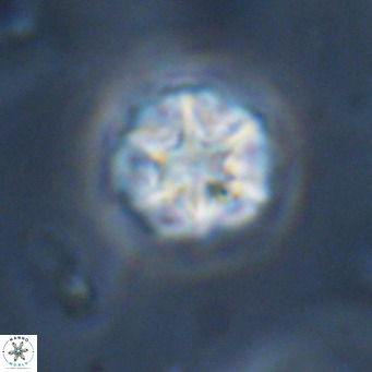 Olladiscoaster catinatus VR 18489