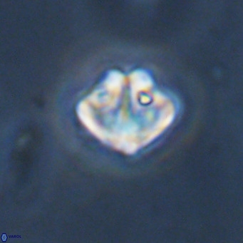Olladiscoaster catinatus VR 18490