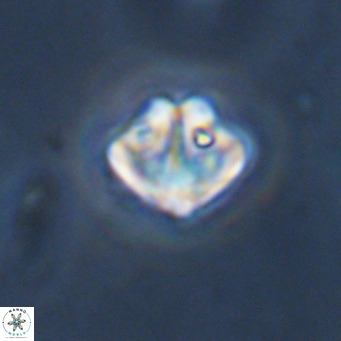 Olladiscoaster catinatus VR 18490