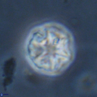 Olladiscoaster catinatus VR 18491