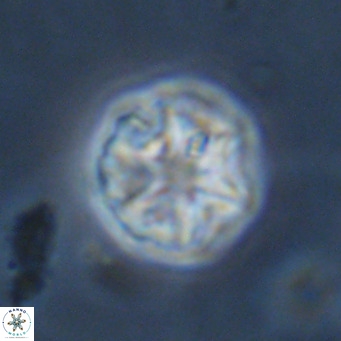 Olladiscoaster catinatus VR 18491