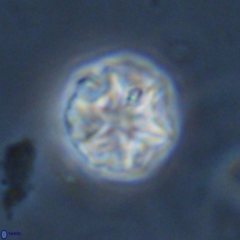 Olladiscoaster catinatus VR 18492