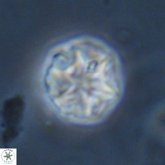 Olladiscoaster catinatus VR 18492