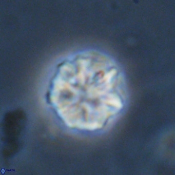 Olladiscoaster catinatus VR 18493