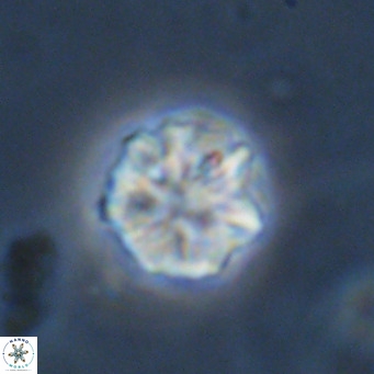 Olladiscoaster catinatus VR 18493