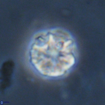 Olladiscoaster catinatus VR 18494