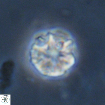 Olladiscoaster catinatus VR 18494