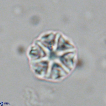 Olladiscoaster catinatus VR 18496
