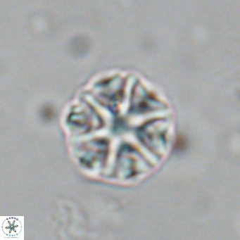 Olladiscoaster catinatus VR 18496