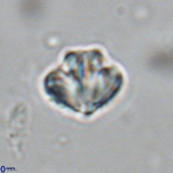 Olladiscoaster catinatus VR 18497
