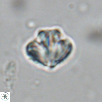 Olladiscoaster catinatus VR 18497