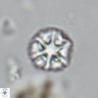 Olladiscoaster catinatus VR 18498