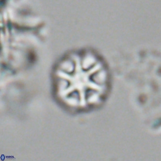 Olladiscoaster catinatus VR 18906