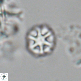 Olladiscoaster catinatus VR 18906