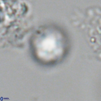 Olladiscoaster catinatus VR 18907