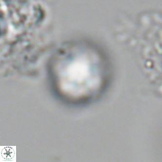 Olladiscoaster catinatus VR 18907