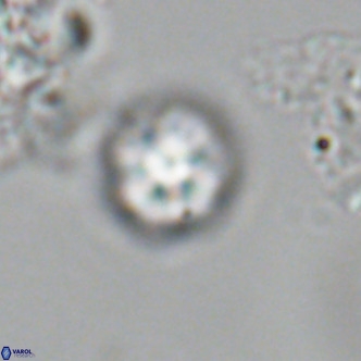Olladiscoaster catinatus VR 18908
