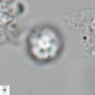 Olladiscoaster catinatus VR 18908