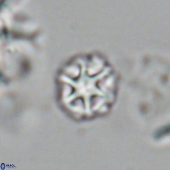Olladiscoaster catinatus VR 18909
