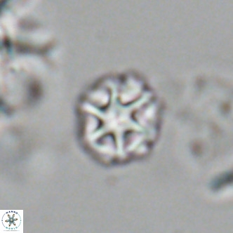 Olladiscoaster catinatus VR 18909
