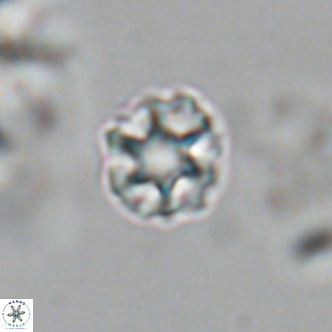 Olladiscoaster catinatus VR 18910