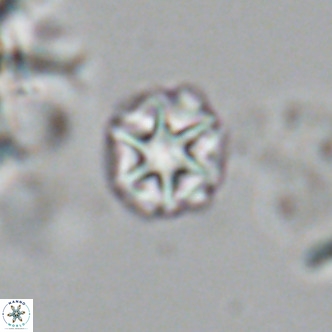 Olladiscoaster catinatus VR 18912
