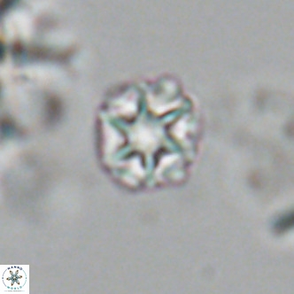 Olladiscoaster catinatus VR 18914