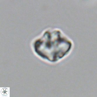 Olladiscoaster catinatus VR 18915