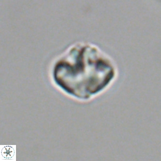 Olladiscoaster catinatus VR 18916