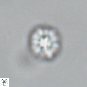 Olladiscoaster catinatus VR 18919