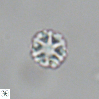 Olladiscoaster catinatus VR 18921