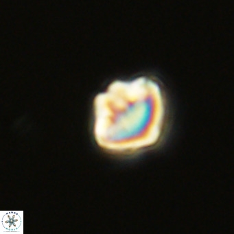 Olladiscoaster catinatus VR 18926