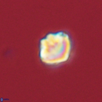 Olladiscoaster catinatus VR 18927
