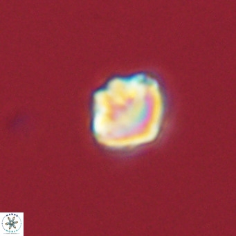 Olladiscoaster catinatus VR 18927