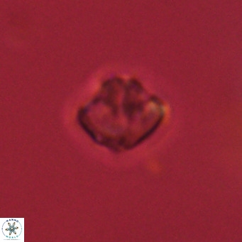 Olladiscoaster catinatus VR 18932