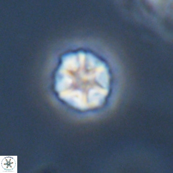 Olladiscoaster catinatus VR 18938