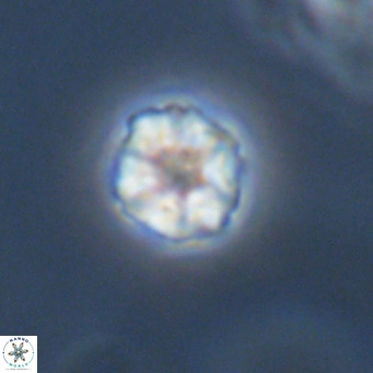 Olladiscoaster catinatus VR 18939