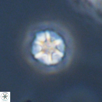 Olladiscoaster catinatus VR 18940