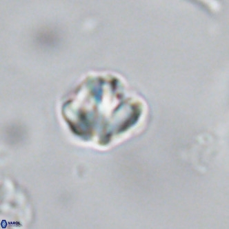 Olladiscoaster catinatus VR 18339