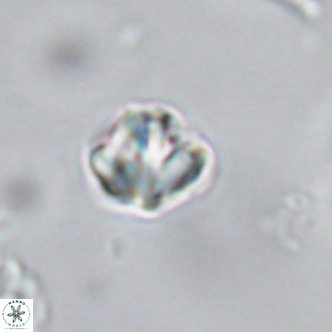 Olladiscoaster catinatus VR 18339