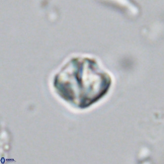 Olladiscoaster catinatus VR 18340