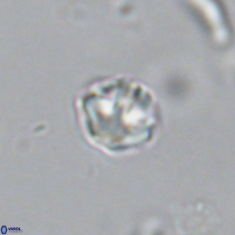 Olladiscoaster catinatus VR 18341