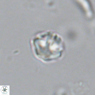 Olladiscoaster catinatus VR 18341