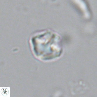 Olladiscoaster catinatus VR 18342