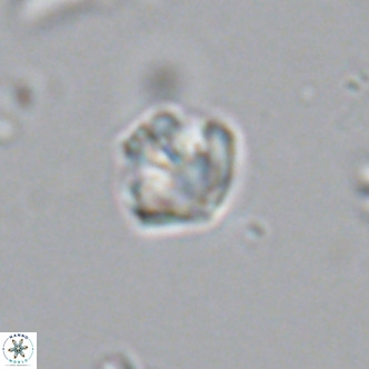 Olladiscoaster catinatus VR 18343