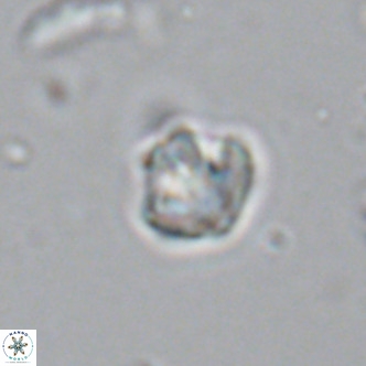 Olladiscoaster catinatus VR 18344