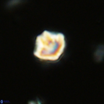 Olladiscoaster catinatus VR 18345