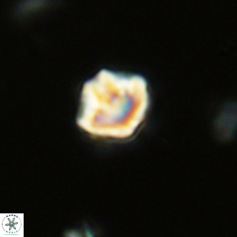 Olladiscoaster catinatus VR 18345