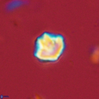 Olladiscoaster catinatus VR 18346