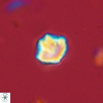 Olladiscoaster catinatus VR 18346